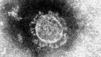 Photo of 2 người Nhật Bản trở về từ Vũ Hán vào cuối tháng 1 nhiễm COVID-19 (2019-nCoV, coronavirus)