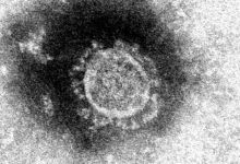 Photo of 2 người Nhật Bản trở về từ Vũ Hán vào cuối tháng 1 nhiễm COVID-19 (2019-nCoV, coronavirus)